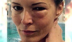 Ilona Felicjańska poświęciła się na rzecz nowego show. Pokazała podbite oko!