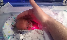 Mama myślała, że jej półkilowy wcześniak nie żyje. Wtedy lekarz wziął reklamówkę i stał się cud