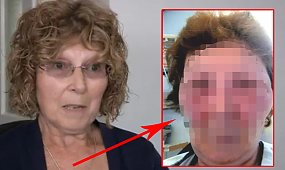 63-latka omal nie zmarła po tym, co wstrzyknięto jej w twarz. Zdjęcie tuż po zabiegu przeraża!