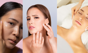 Cera tłusta - charakterystyka, sposoby pielęgnacji, proponowane kosmetyki. Wszystko, co chcesz wiedzieć