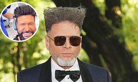 Krzysztof Rutkowski zrobił sobie przeszczep włosów. Detektyw o nowej fryzurze: "Pięknie się przyjął" [zdjęcie]