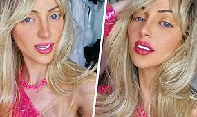 "Nieludzka Lalka" nie żyje. Ostatnie słowa 31-latki, która chciała wyglądać jak Barbie, mrożą krew w żyłach