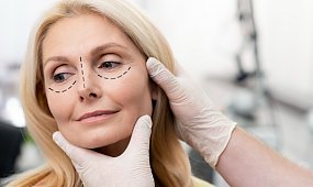 Lifting twarzy po 40. roku życia - kiedy zabieg ma sens, a kiedy wystarczy dobra pielęgnacja?