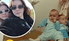 Polskie bliźniaczki syjamskie zmieniły się nie do poznania. Tak dziś wyglądają. Niewiarygodne, czym zajmują się na co dzień [dużo zdjęć]