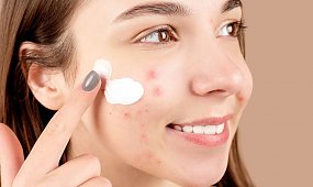 Najlepsze kosmetyki na trądzik i przebarwienia – ranking
