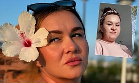 Ta Typiara schudła 30 kg i pokazała obwisłe ciało. Fani przecierają oczy: "Szczęka opada" [zdjęcia]