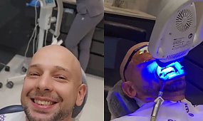 Maciej Pela zafundował sobie śnieżnobiałe zęby w Turcji. Tak walczy ze swoimi kompleksami. Udało się? [zdjęcie]
