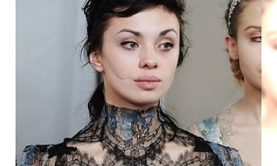 Ania Koryto już bez blizny!