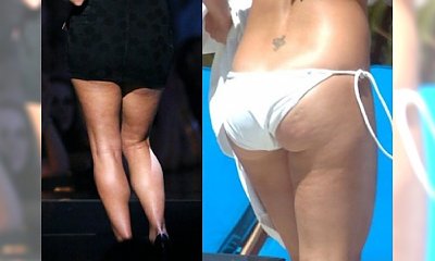 Piękne inaczej - które gwiazdy nie radzą sobie z cellulitem?