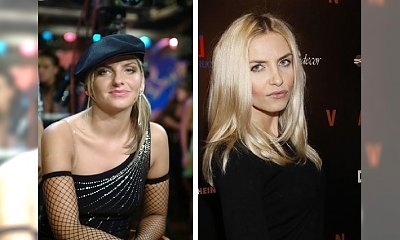 Polscy celebryci po operacjach plastycznych - zdjęcia