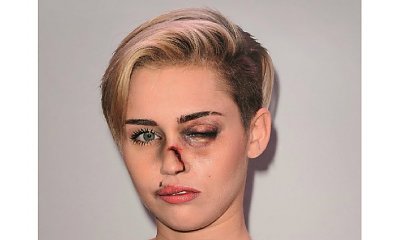Madonna, Aneglina Jolie i inne gwiazdy dotkliwie pobite! Co się stało?