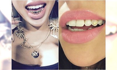 Modna biżuteria na zęby - hit czy kit?