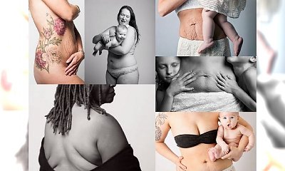 12 mega odważnych kobiet pokazuje, jak wygląda ich ciało po ciąży! Nie wstydzą się tego i pokazują, że macierzyństwo jest w stanie wszystko wynagrodzić!