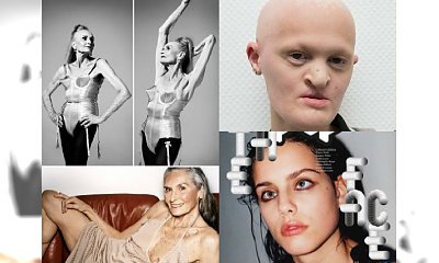 Najbardziej niezwykli modele i modelki świata! Zdziwisz się