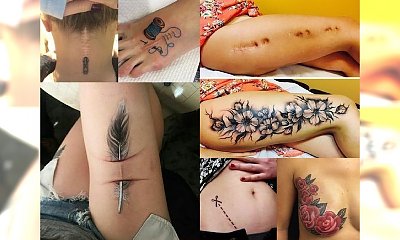 NIEWIARYGODNE! Wstydliwe blizny zamienili w prawdziwe dzieła sztuki! Dzięki tatuażom odzyskali poczucie własnej wartości - to trzeba zobaczyć na własne oczy!