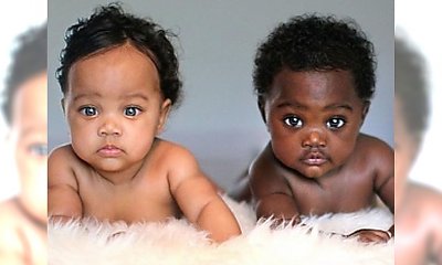 Uwierzysz, że te dwie słodkie dziewczynki są bliźniaczkami? Mają dopiero 7 miesięcy, a już skradły serca Internautów na całym świecie