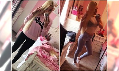 Brazylijski lifting zamiast ćwiczeń pośladków. Zobaczcie, jak teraz wygląda jej pupa!