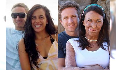 Turia Pitt i Michael Hoskin: Miłość, która przetrwała piekło. "Dlaczego wciąż ją kochasz?"