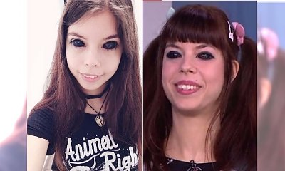 Aleksandra Sadowska straciła wzrok przez tatuaż oczu. Teraz wystąpiła w "DD TVN". "Samego tatuażu nie żałuję"