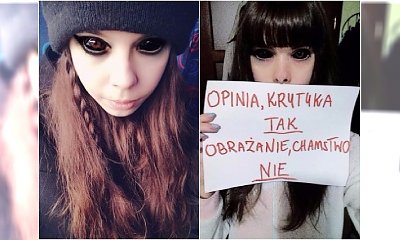 Fanka Popka walczy o wzrok w drugim oku. Czy całkowicie oślepnie? Jest OPINIA LEKARZY