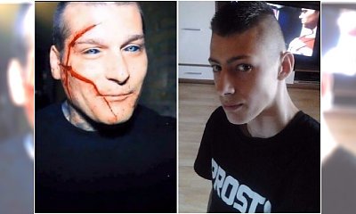 Ola Sadowska to nie jedyna ofiara mody na Popka. Pamiętacie tego chłopaka z pociętą twarzą?