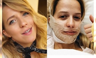 Jessica Mercedes POKAZAŁA TWARZ po operacji żuchwy. Wygląda zupełnie inaczej!