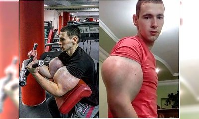 Pamiętacie słynnego "POPEYE'A", który przeholował z syntholem? Nie uwierzycie, jak dziś wygląda!