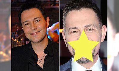 Krzysztof Ibisz ma NOWE ZĘBY! Internauci: "Wyszło trochę strasznie. Jak fortepian"