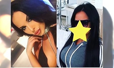 Esmeralda Godlewska powiększyła usta JESZCZE BARDZIEJ! Myśleliście, że nie może być już gorzej?