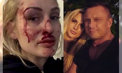 Koszmar SKATOWENEJ przez partnera Katarzyny Dziedzic: "Wiedziałam, że on mnie zatłucze"