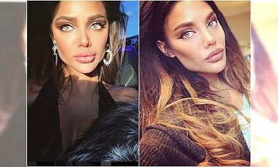 Internet śmieje się z rosyjskiej Angeliny. Po ostatniej operacji przypomina wczesnego Michaela Jacksona