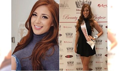 Rok temu została brutalnie oszpecona, a teraz ubiega się o tytuł Miss! Sądzicie, że Sophie Hall ma szanse na koronę piękności?