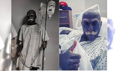 Adam Curlykale ma KOMPLIKACJE po usunięciu penisa i jąder. Prosi fanów o pieniądze! "Nie jestem w stanie spać z powodu silnego bólu"