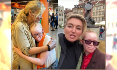 Do Martyny Wojciechowskiej przyjechała adoptowana córka. Była prześladowana z powodu albinizmu. "Maczetą odrąbali jej rękę"