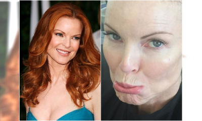 Co się stało z piękną Bree Van De Kamp z "Gotowych na wszystko"?! Marcia Cross wyznała, że to przez chorobę