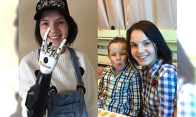 Zazdrosny mąż ODRĄBAŁ jej palce, a potem dłonie, żeby nie mogła więcej obejmować dzieci. Dziś ta dzielna mama świetnie sobie radzi!