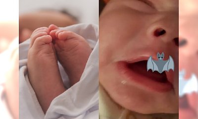 Niemowlęciu urosło to w ustach w ciągu jednej nocy! Przerażona matka natychmiast zawiozła synka do szpitala. "Ofiara WAMPIRA", piszą o nim