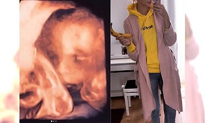 A to NIESPODZIANKA! Gwiazda "TOP MODEL" w ciąży! Pokazała zdjęcie USG