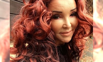 51-letnia Minge pokazuje BOSKIE CIAŁO w bikini. "Zafundowałam sobie SZTUCZNE CYCKI zamiast uszu spaniela. Myślę o plastyce brzucha"