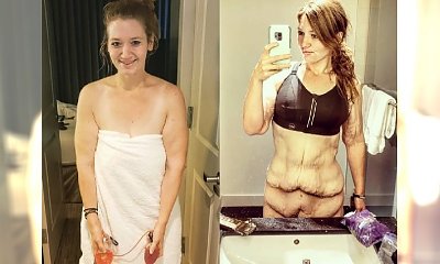 Odważnie pokazywała ciało po zrzuceniu 140 kilogramów. Po odchudzeniu zostały jej ciężkie płaty nieestetycznej skóry