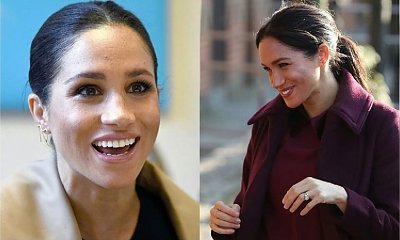 Szał na punkcie Meghan Markle sprawia, że CHIRURDZY mają pełne ręce roboty. Ale nie uwierzycie, za co fanki są gotowe zapłacić w klinikach estetycznych!