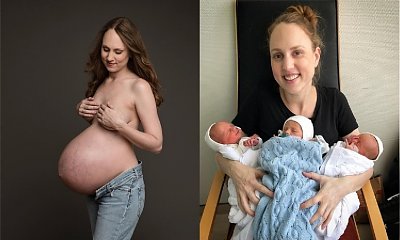 Mama trojaczków szczerze pokazała, jak NAPRAWDĘ wygląda jej brzuch po ciąży. Teraz kobiety dziękują jej za to zdjęcie