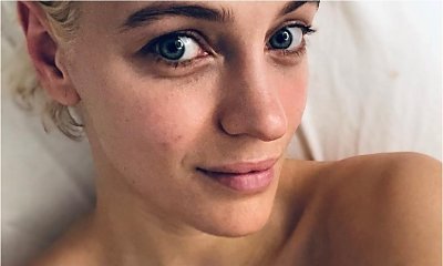 Renata Kaczoruk oszpeciła się nowym kolorem włosów? "Kto to zrobił tak pięknej kobiecie?!"