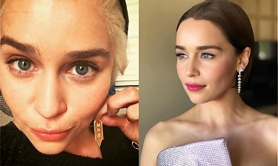Emilia Clarke otarła się o śmierć! "W najgorszych momentach nie chciałam żyć", wyjawiła