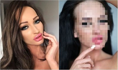 No i wyszło! Tak Małgorzata Godlewska wygląda bez podkładu. SZOK, co ukrywa pod makijażem!