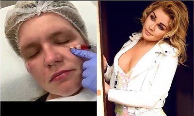 Asia z "Chłopaków do wzięcia" pochwaliła się nową twarzą. Fanki: "Nie rób sobie więcej ust. Te są przesadzone"