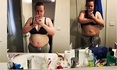 Ta mama pokazała ciało po ciąży i zamieściła odważny wpis: "Dlaczego niby mam kochać swoje ciało?"
