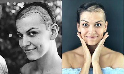 Alżbeta Leńska świętuje swoje "pierwsze urodziny"! Dokładnie rok temu w jej głowie pękł krwiak. Zobaczcie, jak dziś wygląda