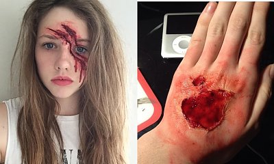 Co się stało córce Ewy Gawryluk? Wygląda jak z horroru. Galeria dla osób o mocnych nerwach!