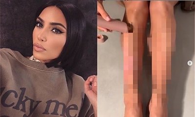 Tak naprawdę wyglądają nogi Kim Kardashian. Gwiazda pokazała, co przez chorobę codziennie zakrywa warstwą podkładu